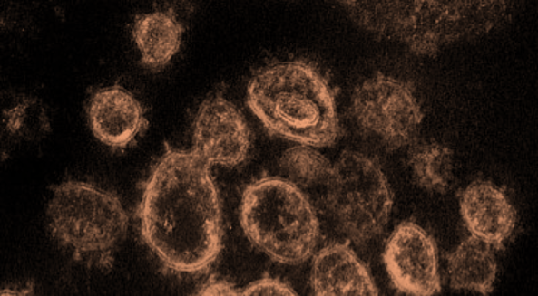 Coronavirus and the medical device industry